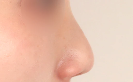 before_image