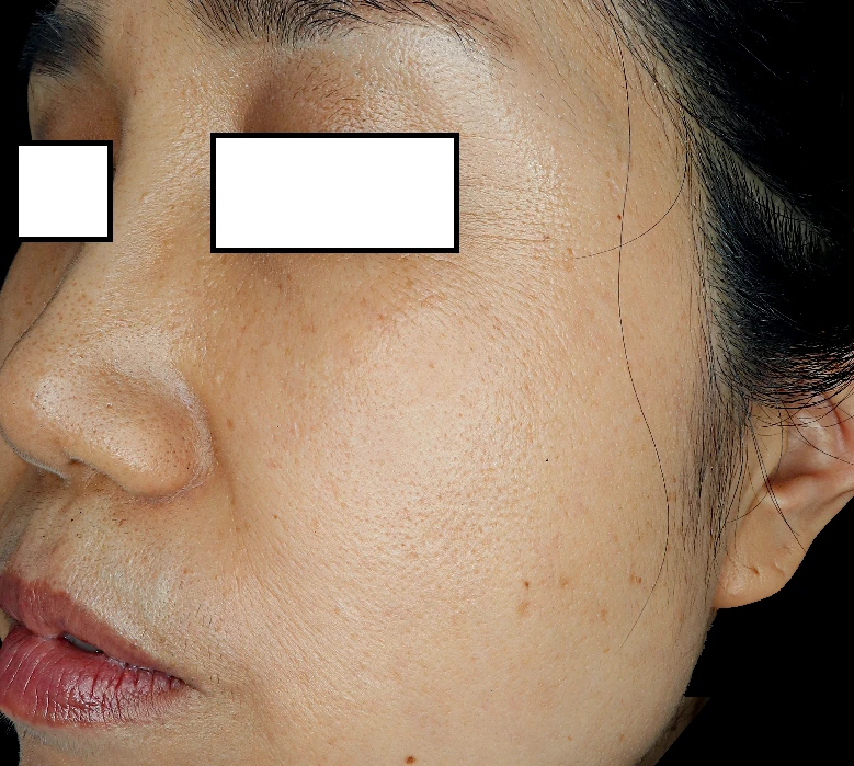 before_image