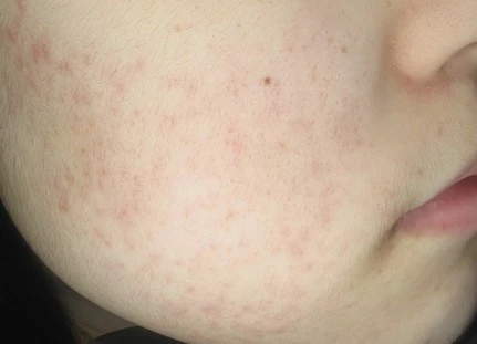 before_image