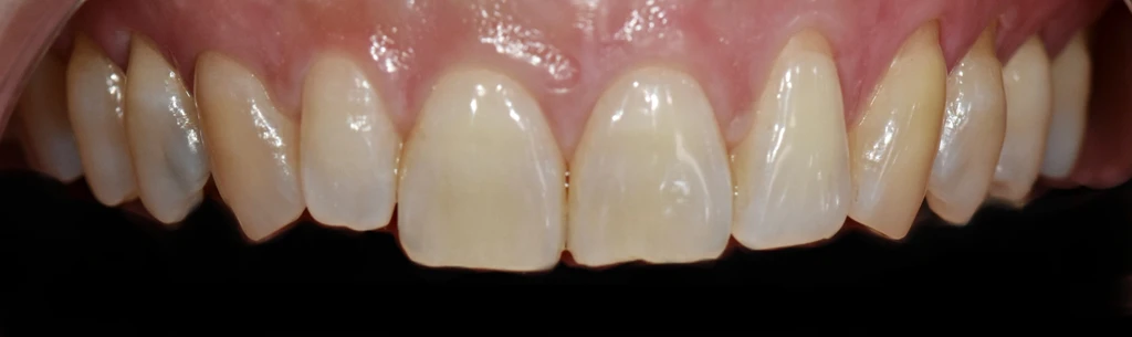 before_image