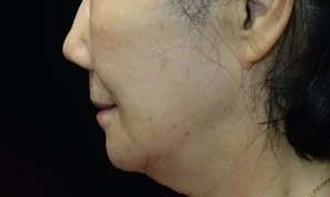before_image