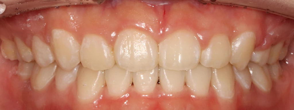 before_image