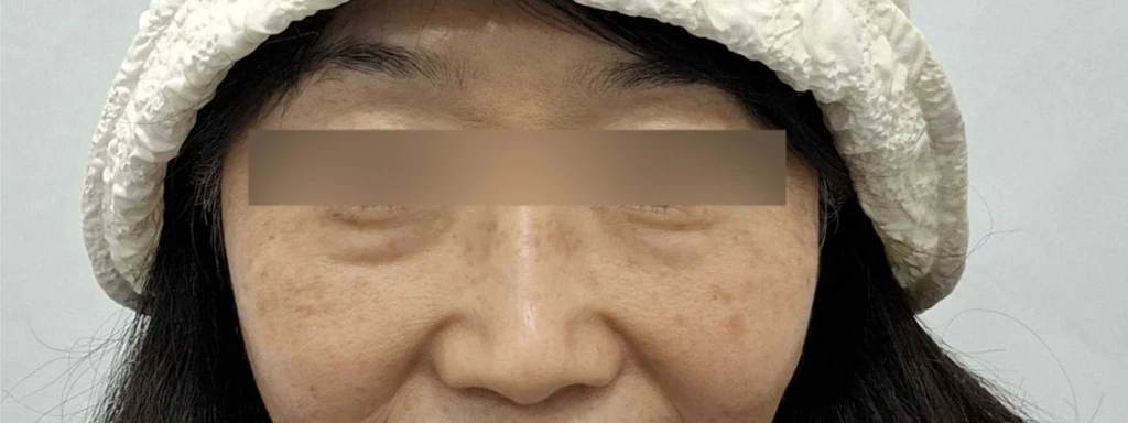 before_image