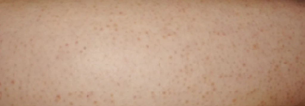 before_image