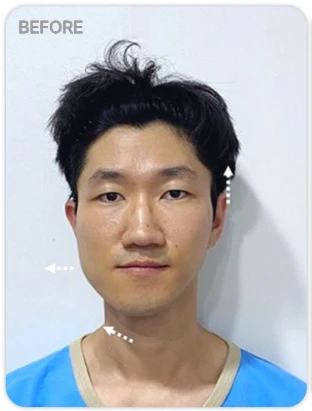 before_image