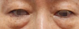 before_image
