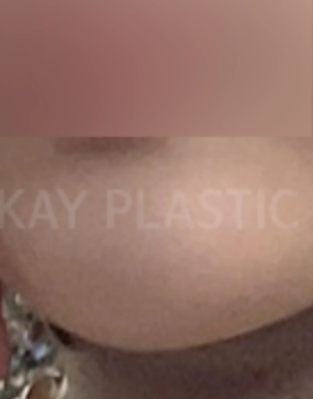 before_image
