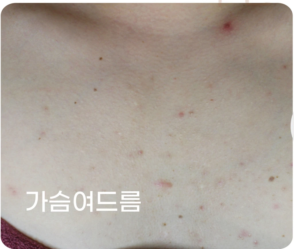 before_image
