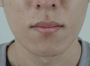 before_image