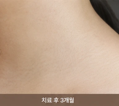 before_image