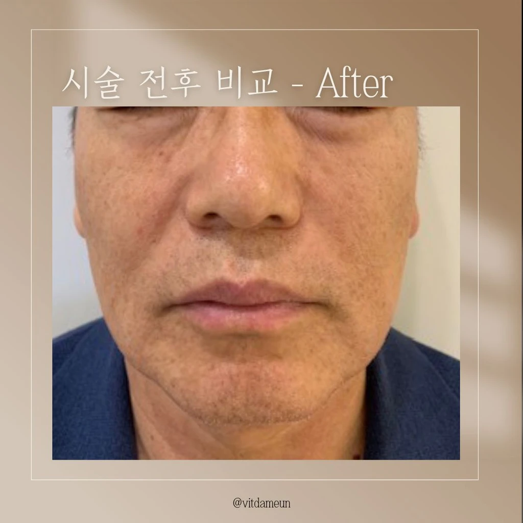 before_image