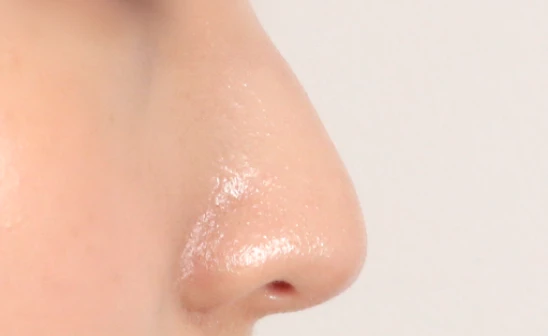 before_image