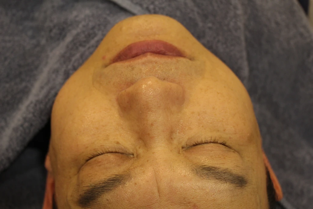 before_image