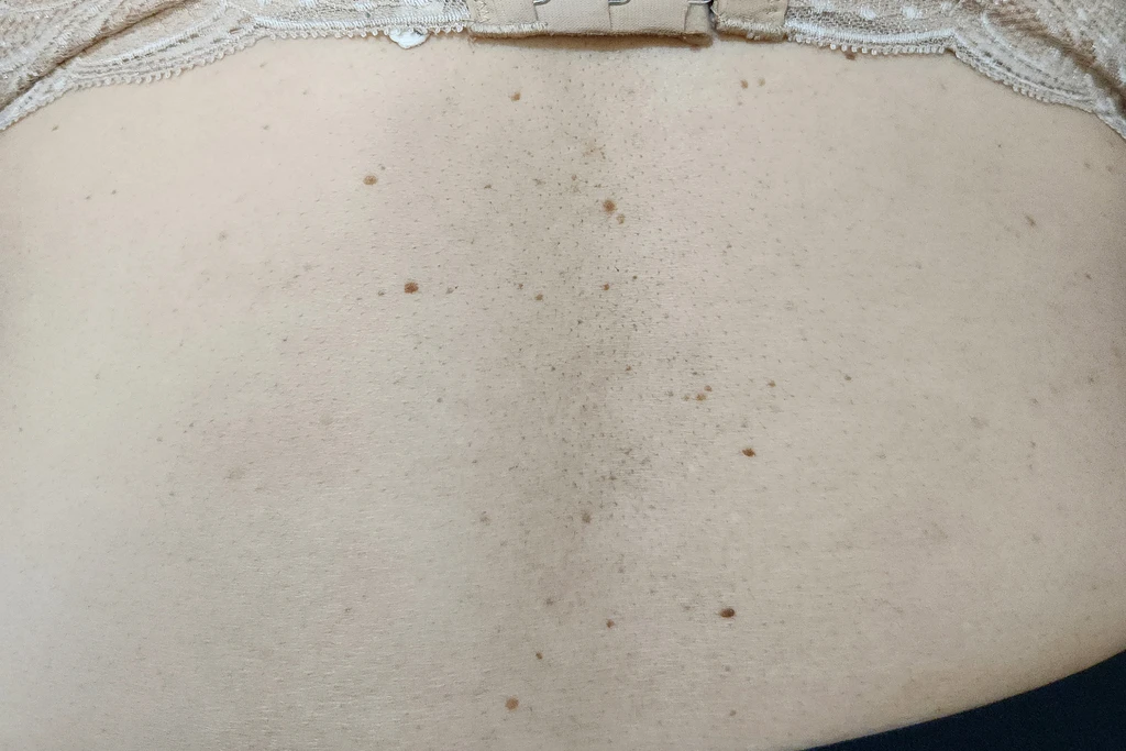 before_image