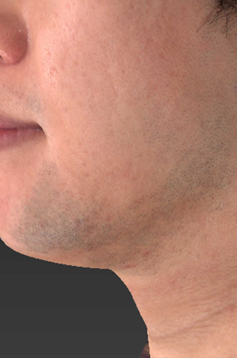 before_image