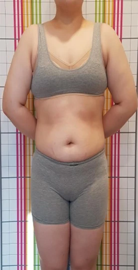 before_image