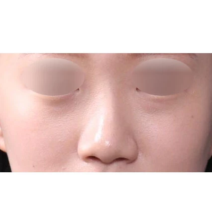 before_image