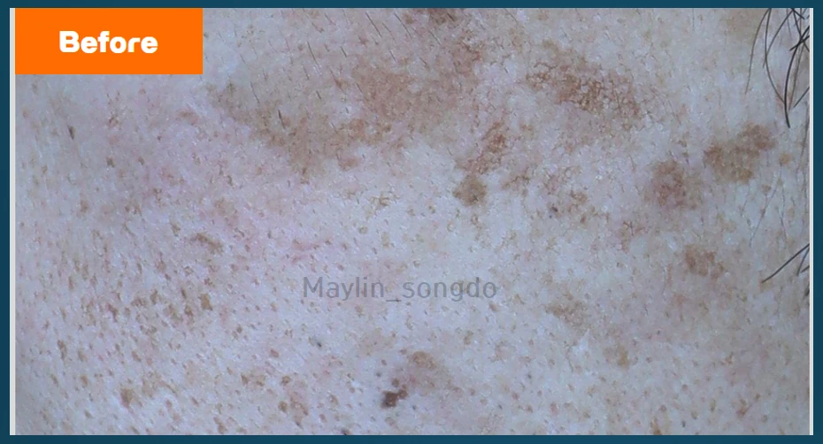 before_image