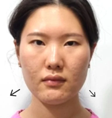 before_image