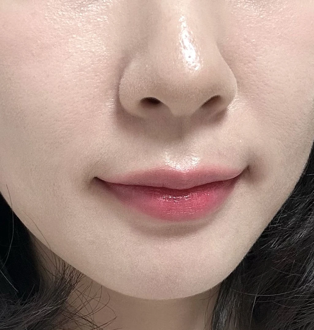 before_image