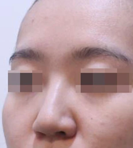before_image