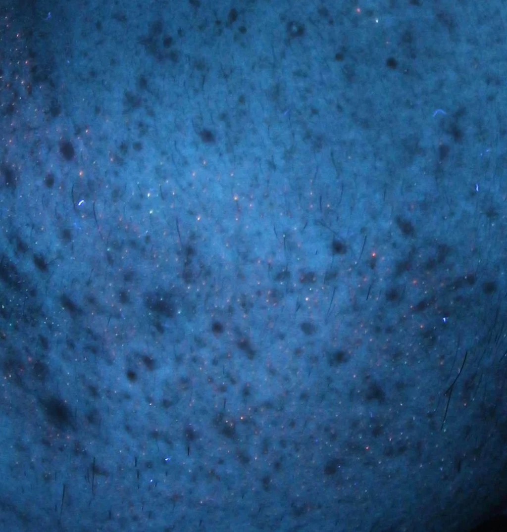 before_image