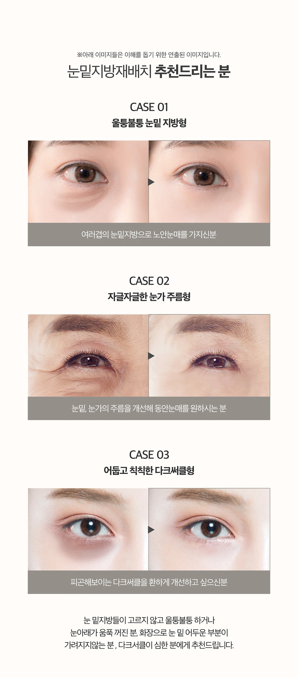 treatmentIntroduction