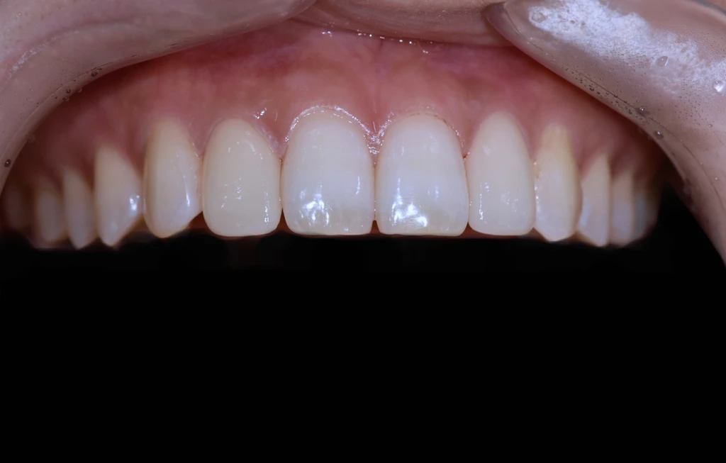 before_image