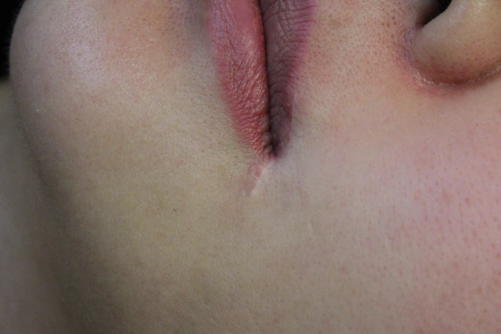 before_image