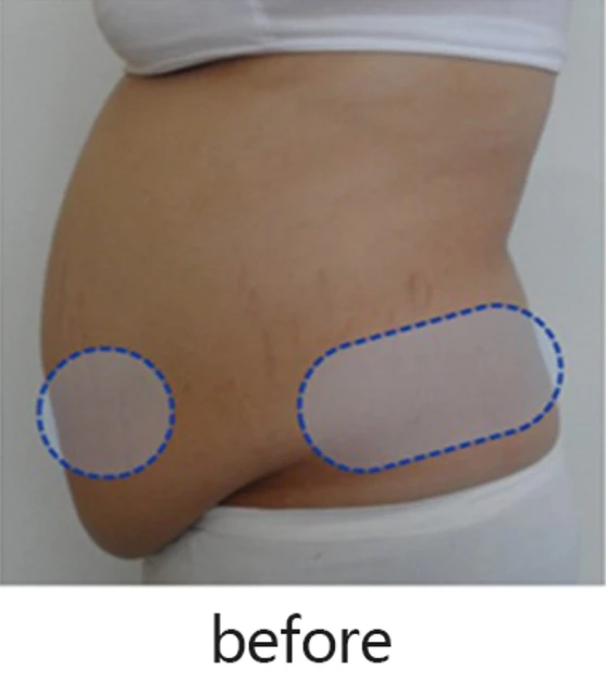 before_image