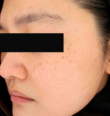 before_image