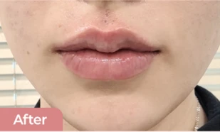 before_image