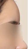 before_image
