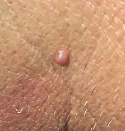 before_image