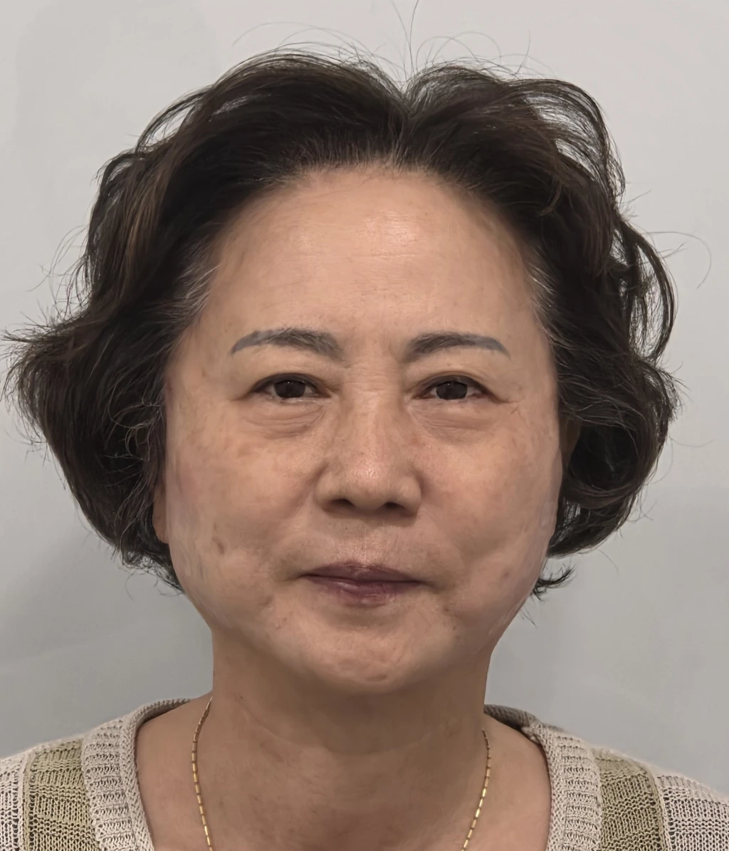 before_image