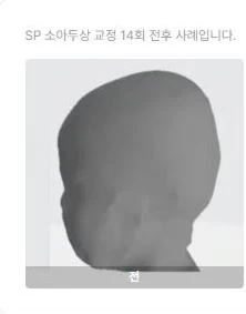 before_image