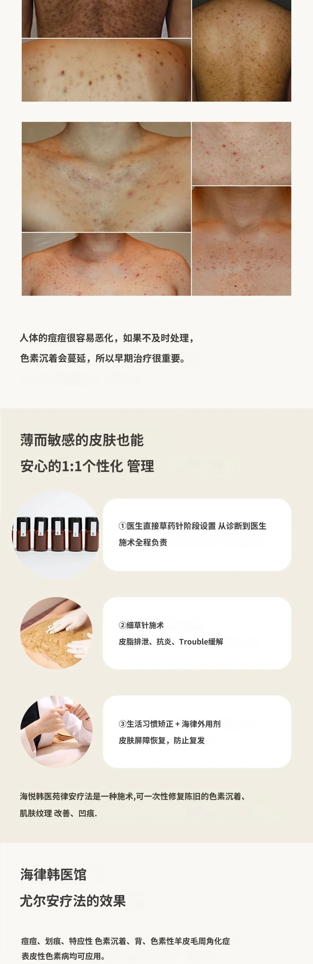 treatmentIntroduction