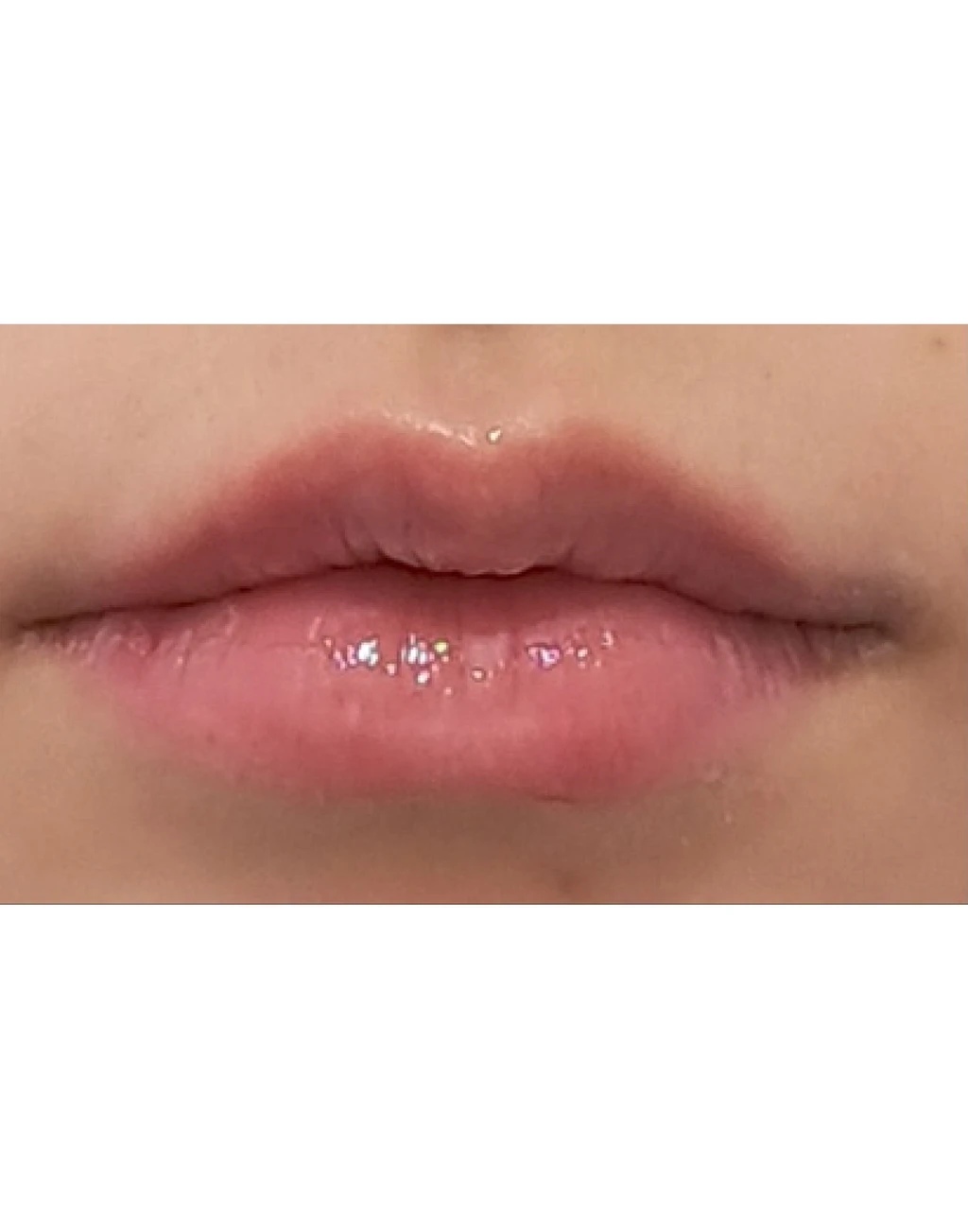 before_image