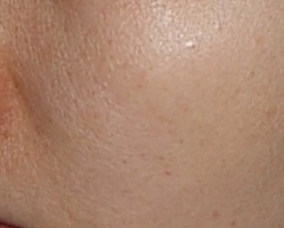 before_image