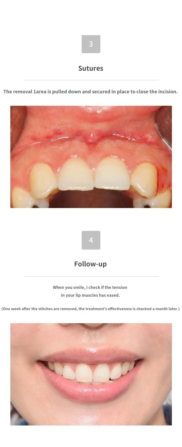 treatmentIntroduction