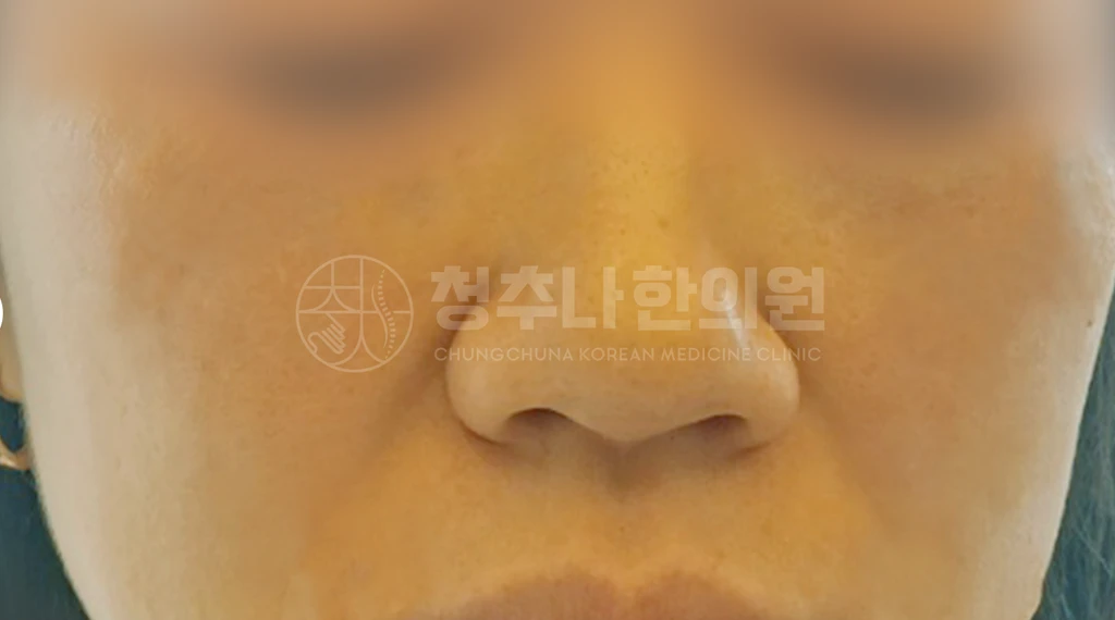 before_image