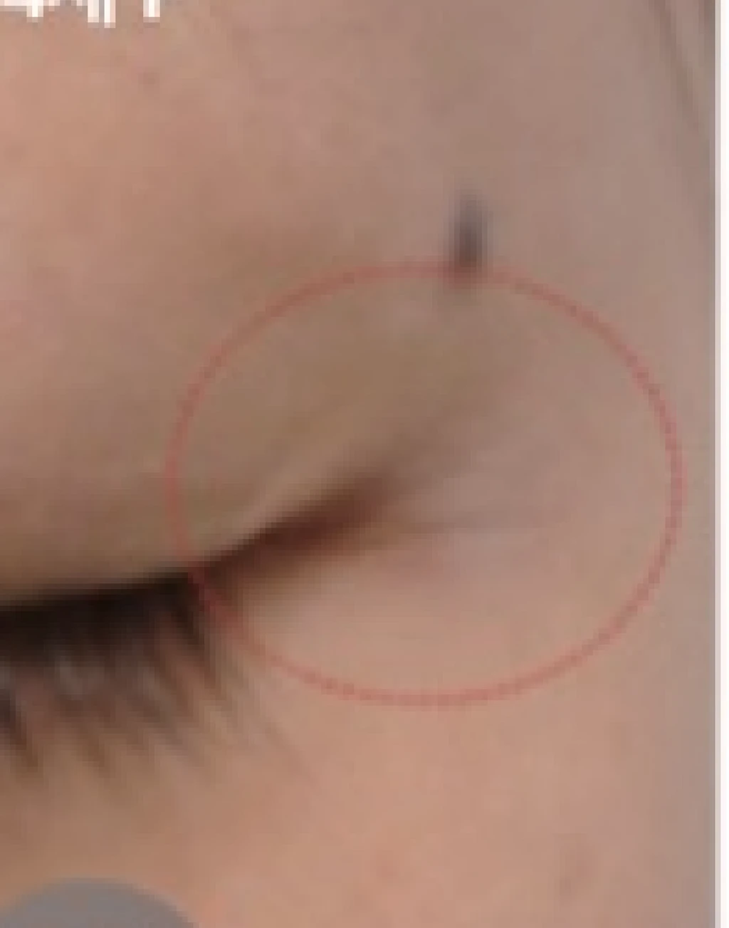 before_image