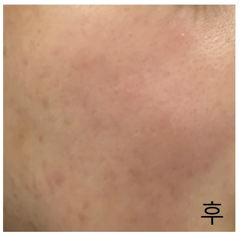 before_image