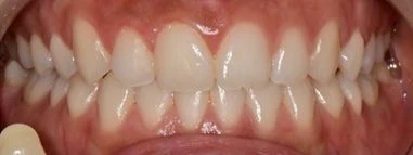 before_image