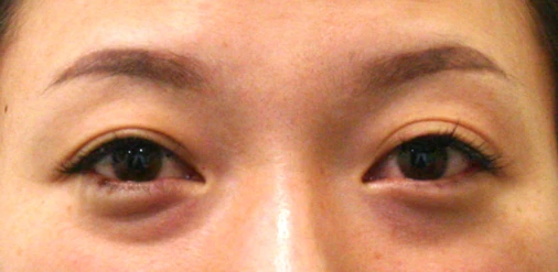 before_image