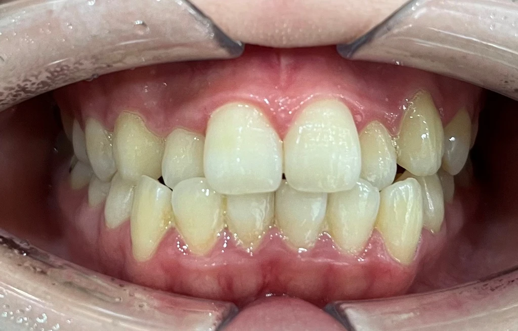 before_image