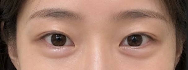 before_image