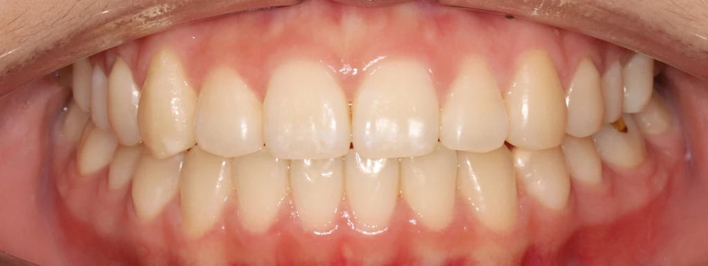 before_image
