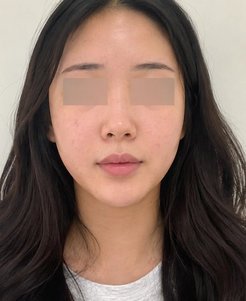 before_image
