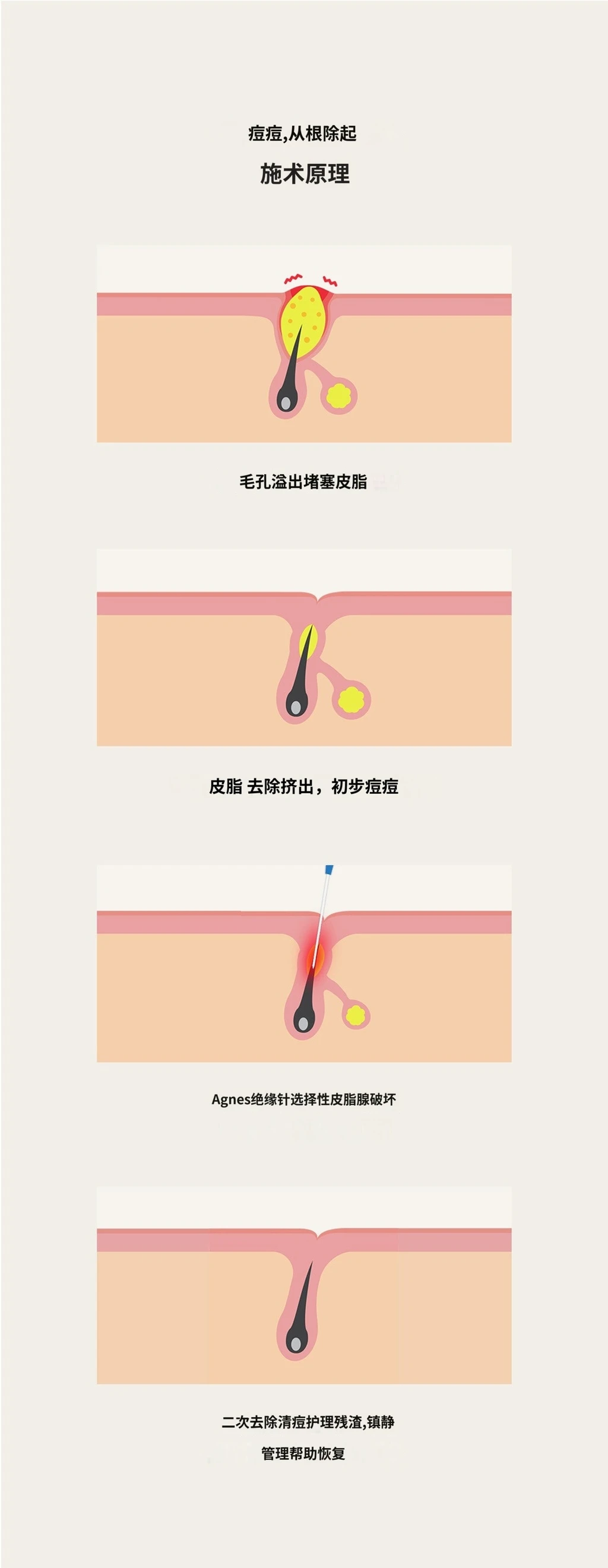 treatmentIntroduction